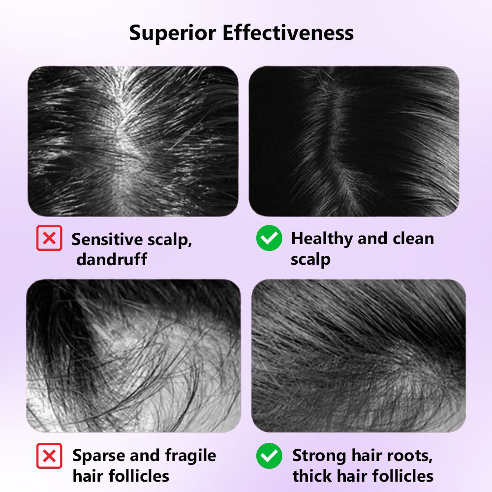 Bacololo™ Scalp massage and hair care machine